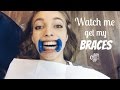 Watch me get my Braces off!!!