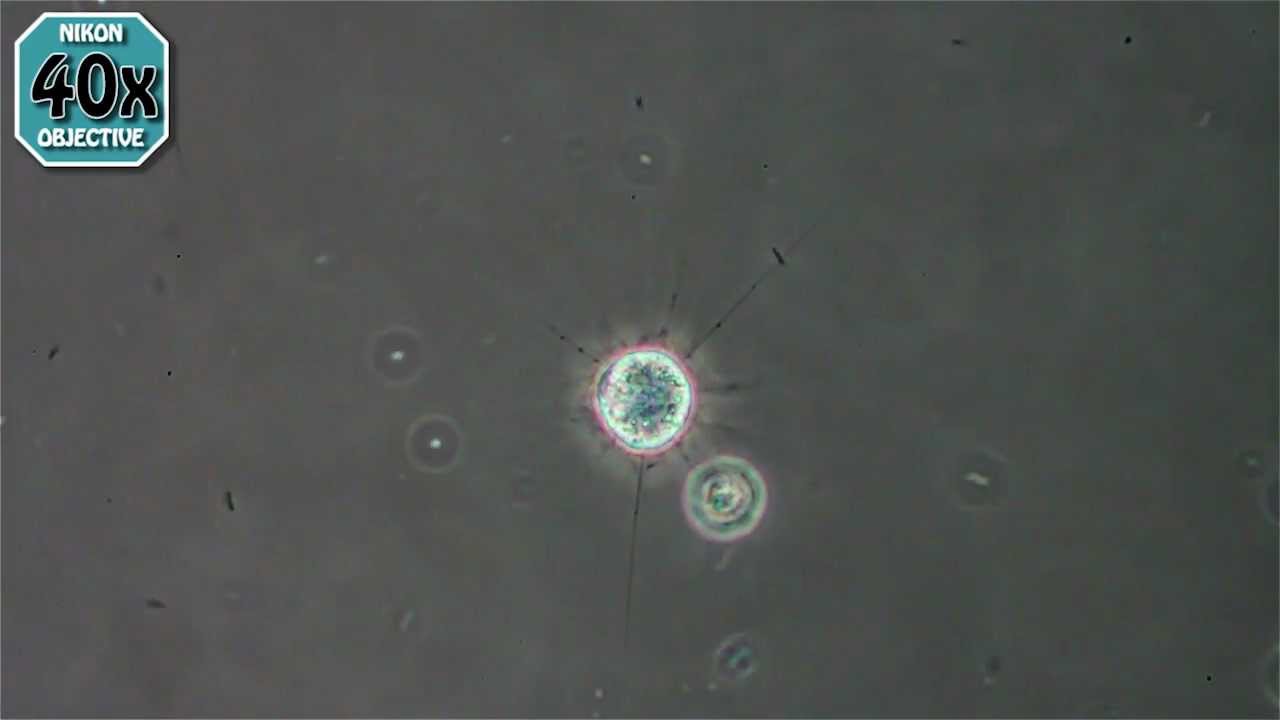 Heliozoa - Actinophrys - YouTube