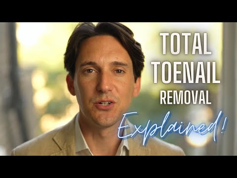 Total Nail Avulsion for Painful Toenails Explained