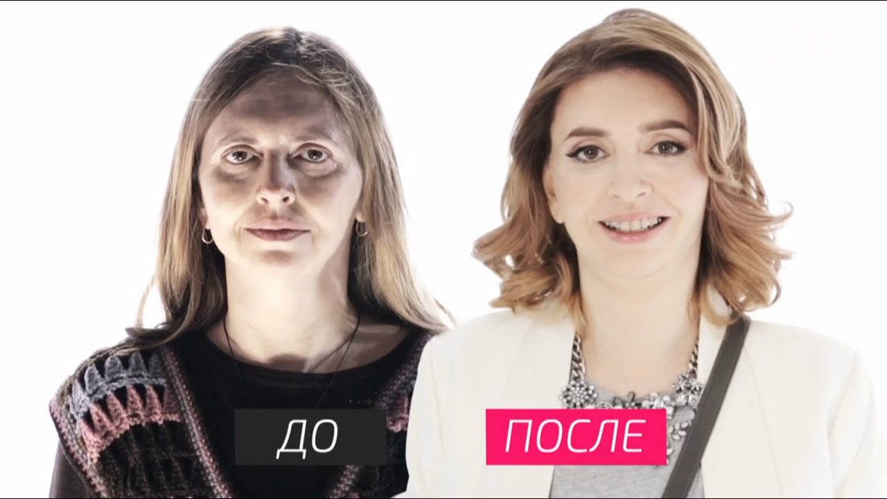 На 10 лет моложе - Как устанавливают брекеты - YouTube