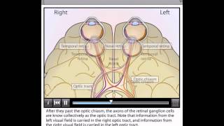 Visual Pathways Final