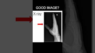 Don’t Lose Marks — Is This a Good Lateral Hand X-ray?