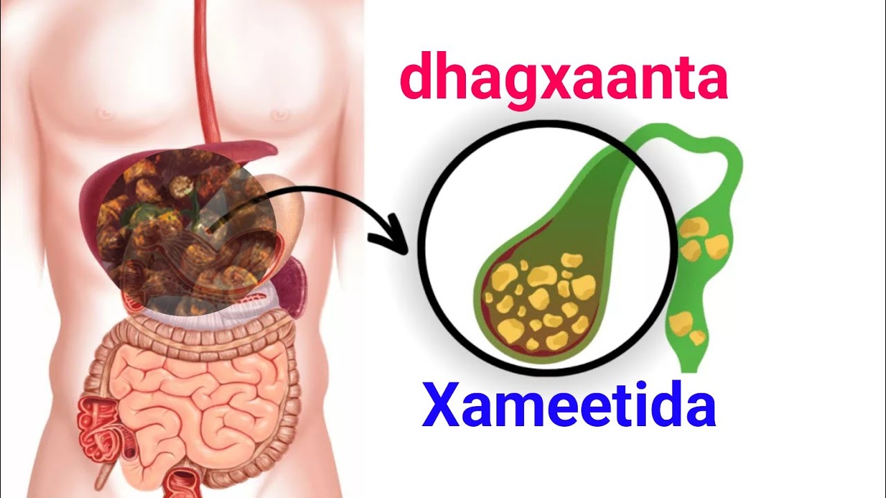 Xameetida dhagxaanta ku sameeysma sidee ku bilaawdaan ( qaladaadkaan iska ilaali fadlan )