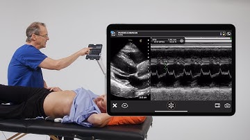 Using EPSS to Assess LV Function