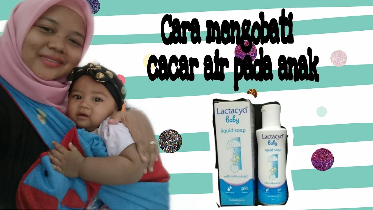 Cara mengobati cacar air pada bayi