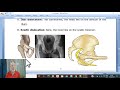 Orthopedic in Arabic 31 ( Dislocation of hip joint , part 1 ) , by Dr. Wahdan