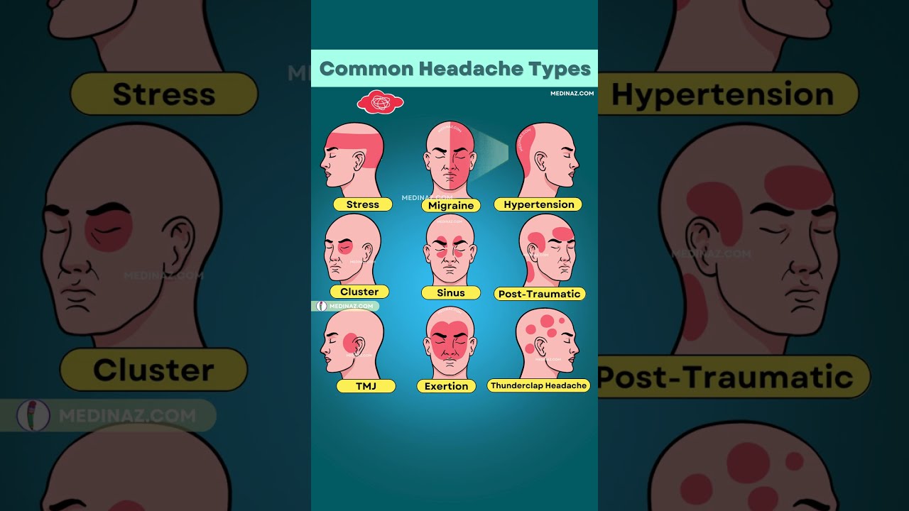 Which Headache Do You Have Tension Migraine Or Something Serious 