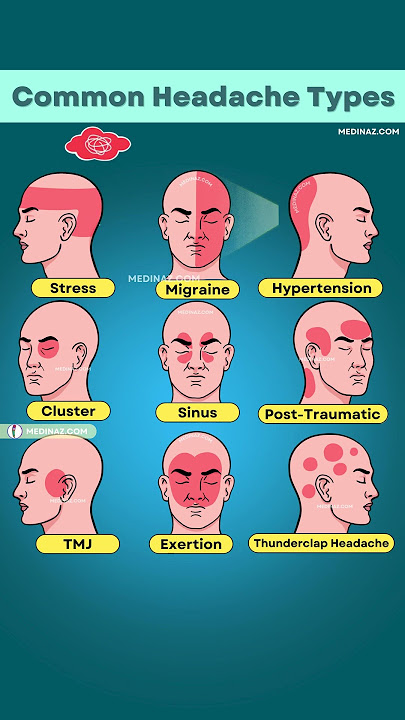 Which Headache Do You Have? 😣 Tension, Migraine, or Something Serious?