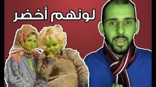 لغز الأطفال الملونين في قرية وولبت