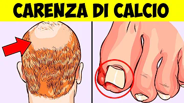 Quale cibo contiene più calcio?
