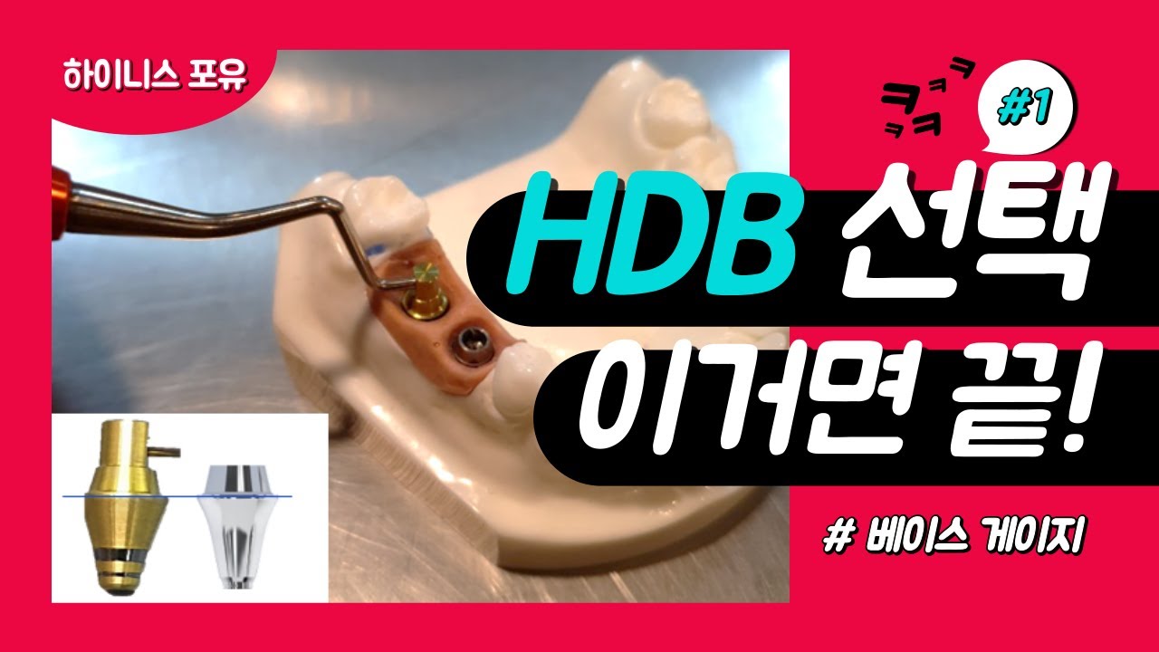 [제품정보] 하이니스 임플란트 Base(HDB) 선택! 이걸로 해결하세요.