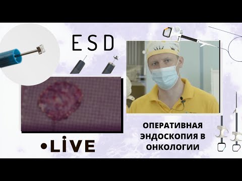 Прямая трансляция из НМИЦ онкологии им. Н. Н. Петрова. ESD. Оперативная эндоскопия в онкологии