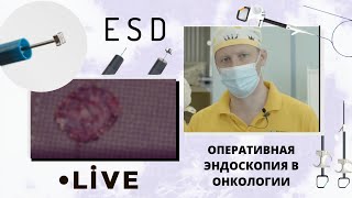 Прямая трансляция из НМИЦ онкологии им. Н. Н. Петрова. ESD. Оперативная эндоскопия в онкологии