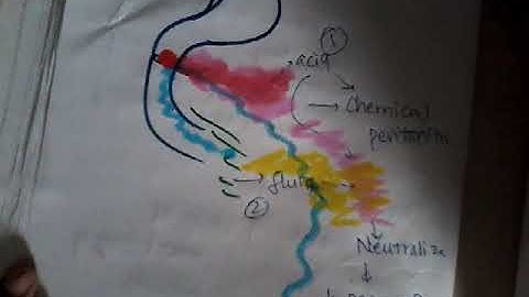 Perforated peptic ulcer || stomach || git