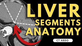 Liver Segments on CT scan | Radiology anatomy part 1 prep | Segmental Liver Anatomy CT