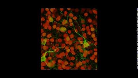 CA1 and CA3 Hippocampal Cells