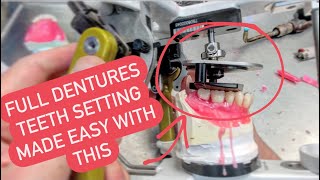 HOW TO SET DENTURE TEETH  (with the 3D setup template) تنضيد اسنان #WAXBAE