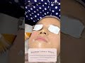 #skincare #dokterspesialiskulitdankelamin #dokterspesialiskulit