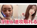 【たった5分】速攻で浮腫みが取れる方法大公開