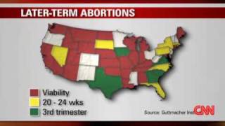 What is a late term abortion?