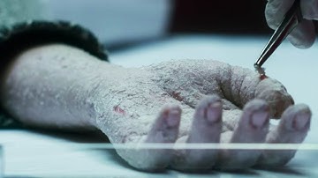 皮膚がはがれていく…!映画『スキン・コレクター』予告編