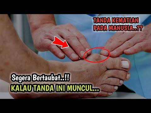 Jika Tanda Ini Sudah Ada Segera Bertaubat ! Tanda Kematian Sudah Dekat