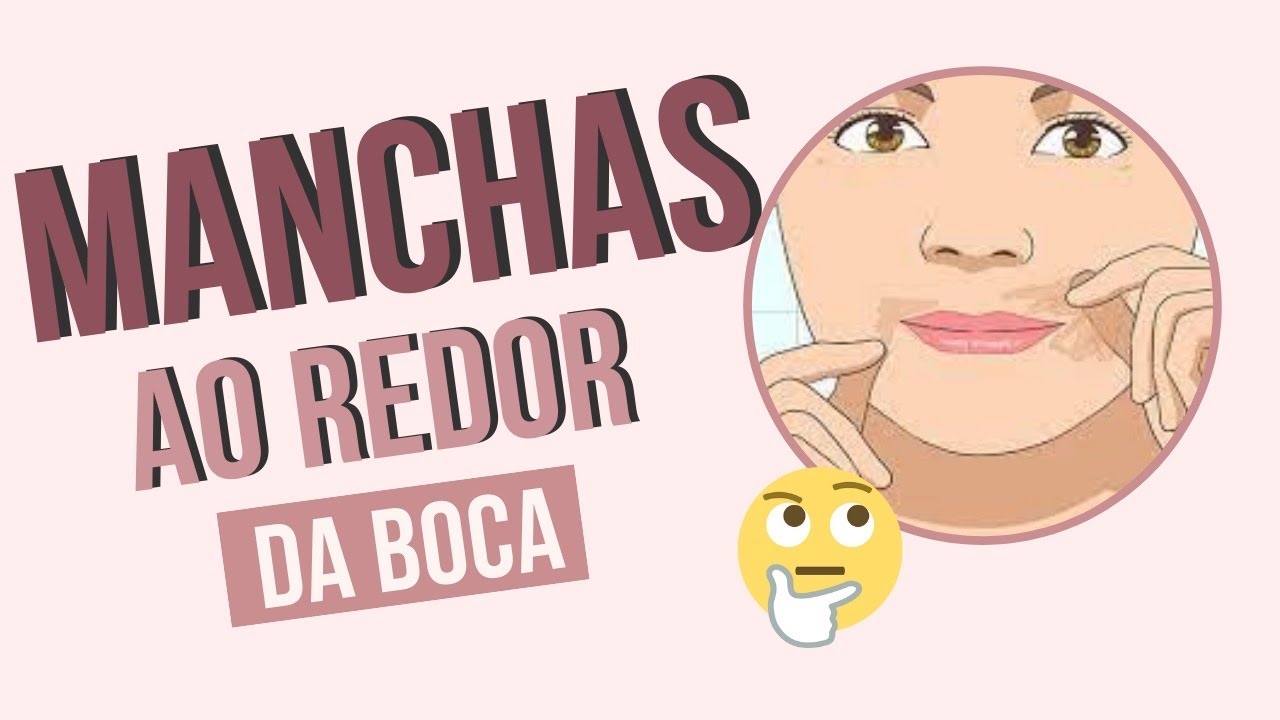 O que podem ser essas manchinhas ao redor da boca? Confira!