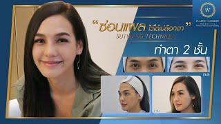 ศัลยกรรมตาสองชั้น