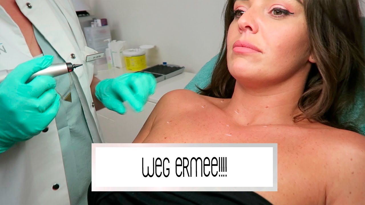botox meaning WEG MET DIE GIGANTISCHE KRENGEN OP MIJN LIJF | Laura Ponticorvo | VLOG #293