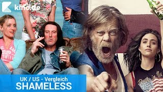 SHAMELESS: Der US/UK-Vergleich