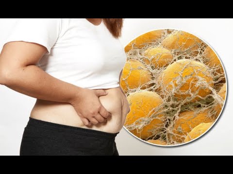 СТЕРИЛЬНЫЙ ПРЕПАРАТ FAT