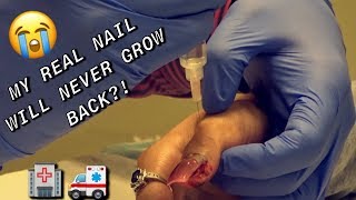 MY REAL NAIL RIPPED OFF (VERY PAINFUL) 😣 | NEVER GETTING ACRYLICS AGAIN!! | *GRAPHIC CONTENT*