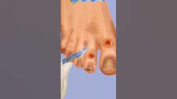 INSANE Screw Match Gameplay | ASMR Blast Sounds | Must Watch