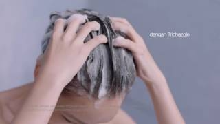 Download lagu Berpikir Dove Bukan Jawaban Rambut Rontok Pikir Lagi