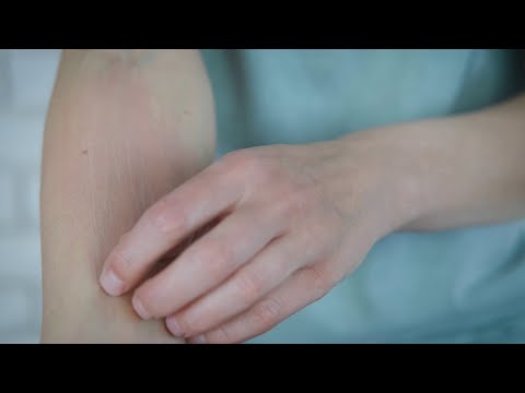 How to Stop an Itch | WebMD