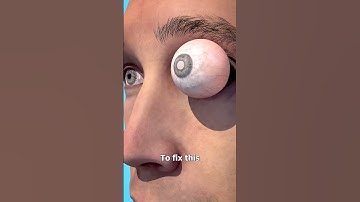 Tooth In Eye Surgery 😨 (explained)