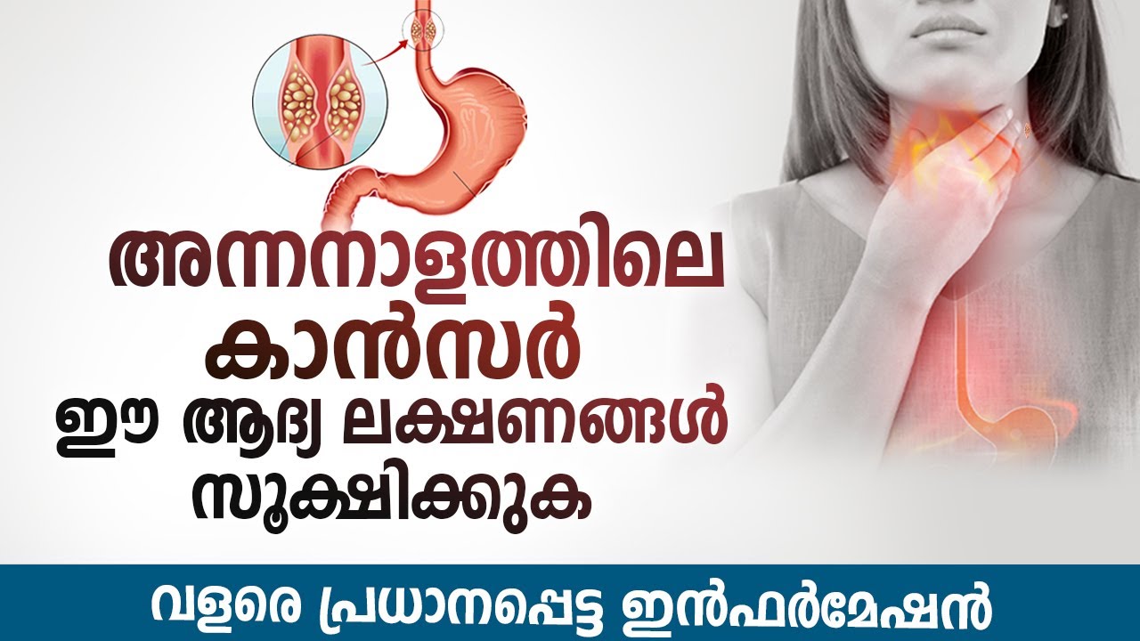 അന്നനാളത്തിലെ കാൻസർ ഈ ലക്ഷണങ്ങൾ സൂക്ഷിക്കുക | വളരെ പ്രധാനപ്പെട്ട ഇൻഫർമേഷൻ