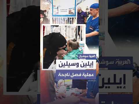 فصل توأمين سياميين سوريين: سيلين وإيلين