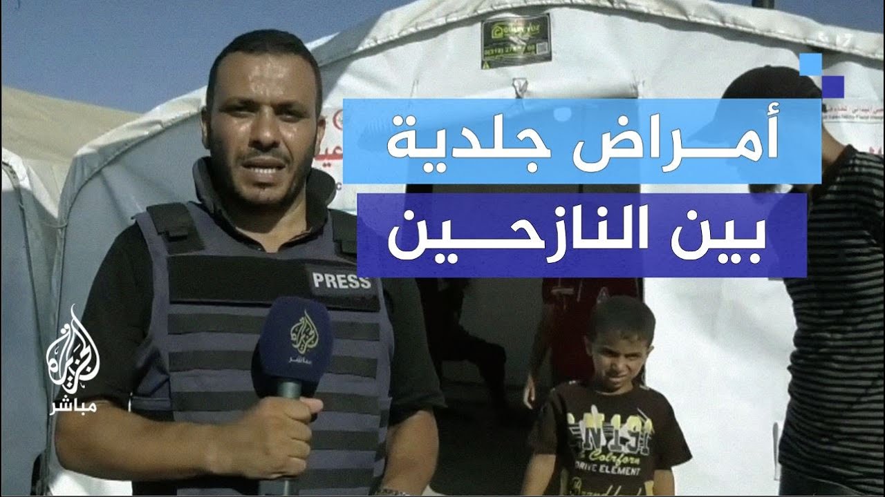 لهذه الأسباب تنتشر الأمراض الجلدية بين النازحين في غزة