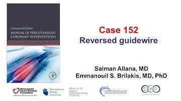 Case 152: PCI Manual - Reversed guidewire