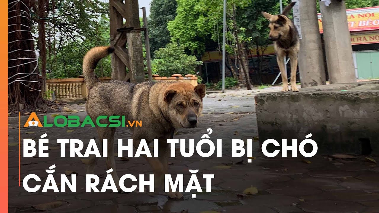 Bé trai hai tuổi bị chó cắn rách mặt - YouTube