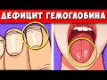 13 Признаков низкого Гемоглобина которые Нельзя Игнорировать, Как быстро поднять Гемоглобин