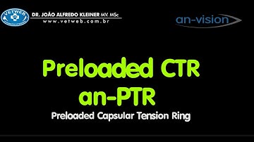 an-PTR Tension Ring Implantation