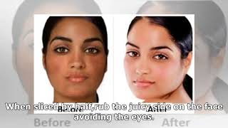 pic How To Lighten Skin At Home Fast youtube