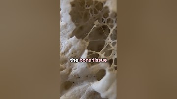 What Exercise Does to Your Bones