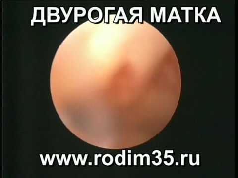 Травой Очень как забеременеть в климаксе подольше наслаждаться присутствием