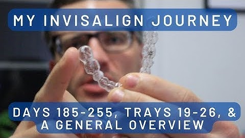 My Invisalign Journey: Days 185-225, Trays 19-26, and a General Overview