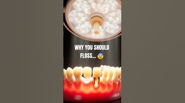Waarom je moet flossen... 😨 #shorts #tanden #gezondelevensstijl #tandarts #wetenschappelijkonderwijs