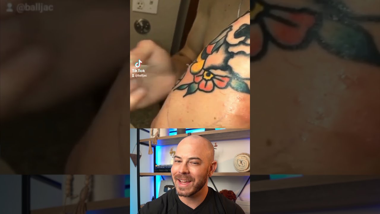 Derm Reacts To Flying Cyst Pop Dermreacts Doctorreacts Cystpop