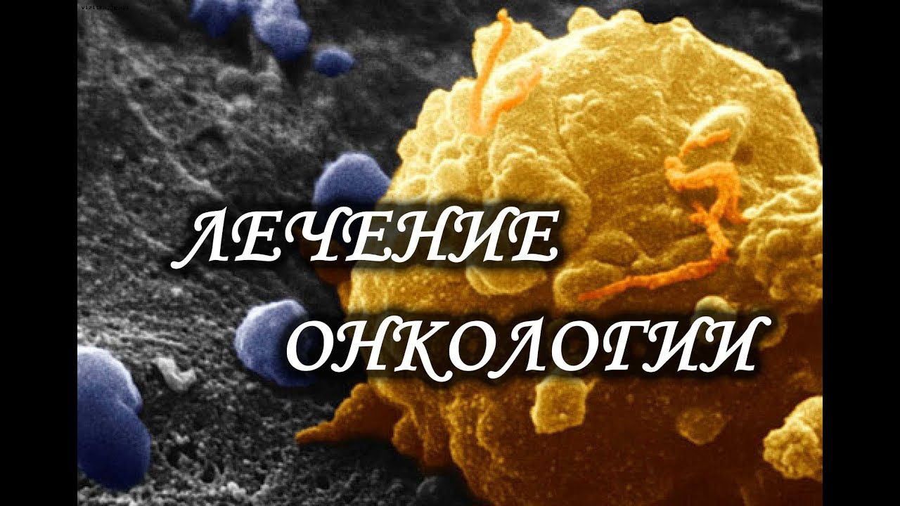 Лечение онкологии. Лаборатория Гипноза. - YouTube